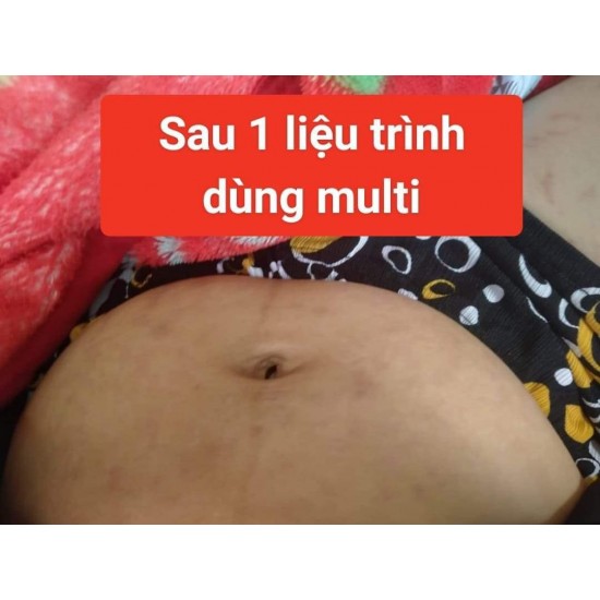 Kem Trị rạn da Multi 16 hũ lớn (Tặng cấy trắng men sữa)
